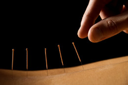 Sabine Frau Hünten Praxis acupuncture