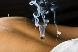 Sabine Frau Hünten Praxis acupuncture