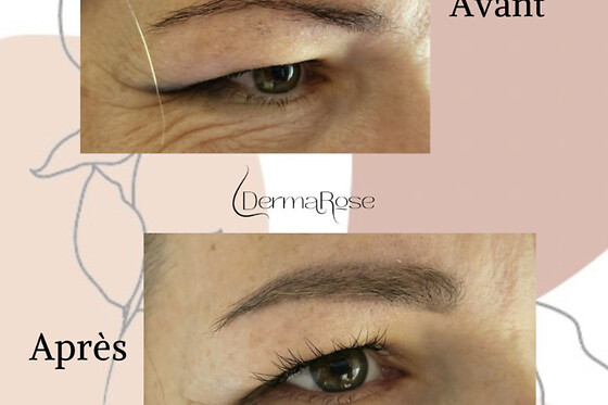 Dermarose - photo 8